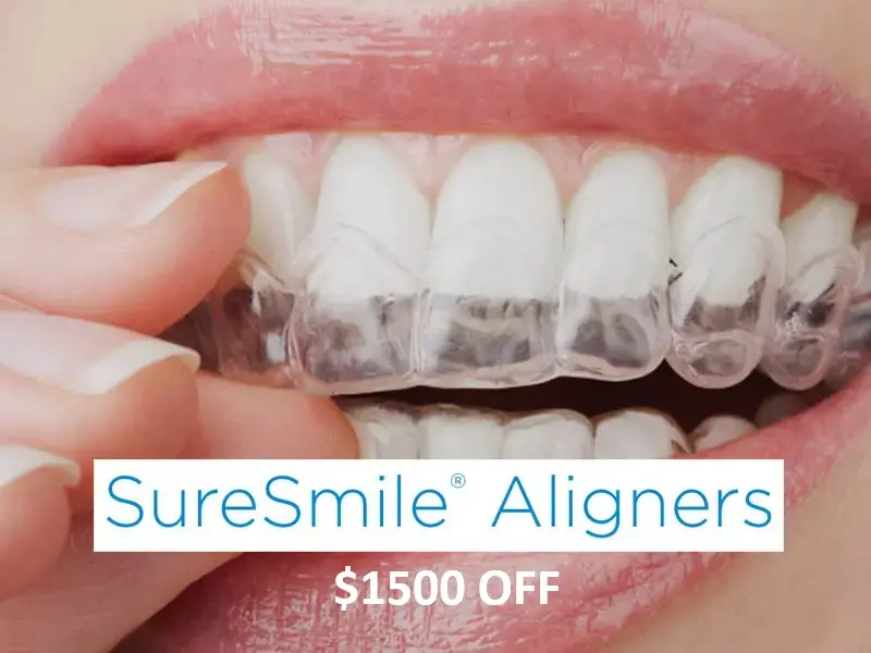 $1500 Discount on Clear Aligners - Radiant Dental